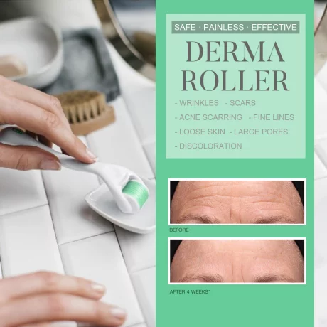 Aparat de masaj facial Dermaroller NEUTRIHERBS, 540 de ace titanium, 0.3 mm