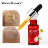 Ser pentru repararea unghiilor, Fungic, Tratament pentru unghii, Elimina onicomicoza Unghiilor, Vibrant Glamour, 15ml