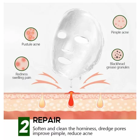Mască pentru tratarea acneei pe bază de plante, Anti-acnee, Reduce semnele de acnee, Hidratant, reparator, Vibrant Glamour