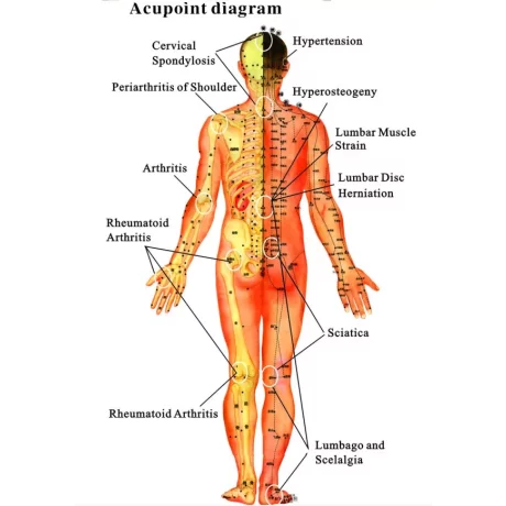 Aparat multifunctional de fizioterapie, electrostimulare, termoterapie, ultrasunete, laser