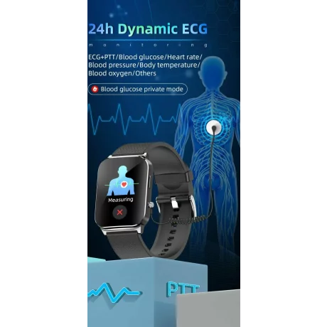 Ceas smartwatch pentru masurarea glicemiei fara intepare, Alhena®, Monitorizare ritm cardiac, Temperatura, EKG+PTT, Pulsul, Precizie glicemie SPO2 BP 24H, Monitorizare sanatate