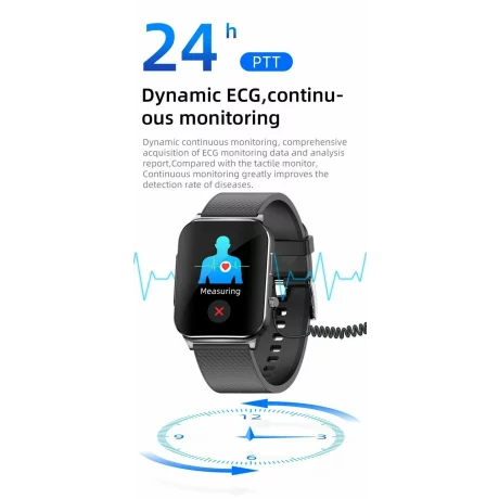 Ceas smartwatch pentru masurarea glicemiei fara intepare, Alhena®, Monitorizare ritm cardiac, Temperatura, EKG+PTT, Pulsul, Precizie glicemie SPO2 BP 24H, Monitorizare sanatate