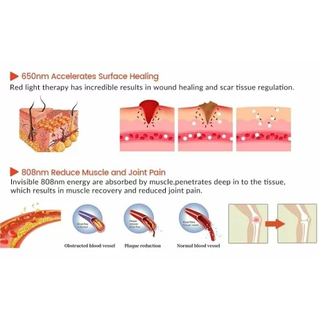 Laser terapeutic profesional, Tratamentul Durerii, Terapie de reabilitare, Regenerarea nervilor, Stomatologie, ORL, Reumatism articular/degenerativ, Vindecarea ranilor, Alhena®, JN-600, alb