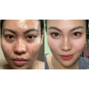 Tretinoin 0.1 %, Gel Anti-Rid Menarini A-Ret Anti-Acnee Depigmentant, 20g