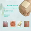 Pansament antiescara, ulcere varicoase, Alhena®, incizii operatorii, utilizat pentru rani cu exudare puternica, din spuma cu adeziv siliconic cu margine blanda pentru ingrijirea ranilor, 10X10 cm