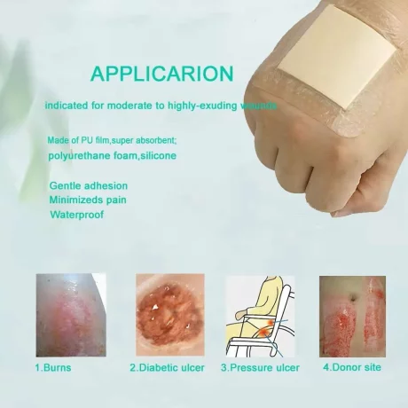 Pansament antiescara, ulcere varicoase, Alhena®, incizii operatorii, utilizat pentru rani cu exudare puternica, din spuma cu adeziv siliconic cu margine blanda pentru ingrijirea ranilor, 10X10 cm