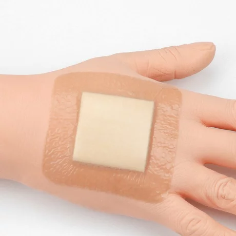 Pansament antiescara, ulcere varicoase, Alhena®, incizii operatorii, utilizat pentru rani cu exudare puternica, din spuma cu adeziv siliconic cu margine blanda pentru ingrijirea ranilor, 5X5 cm