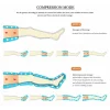 Aparat de presoterapie pentru drenaj limfatic si masaj Alhena® M-PRO 3001, 2 X 6 camere de compresie aer, 6 moduri de tratament, 30-250 mmHg, recuperare medicala, masaj terapeutic, refacere musculara, marimea M, negru