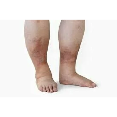Aparat de presoterapie pentru drenaj limfatic si masaj pantalon talie inalta Alhena®M-PRO 3001, 2 X 8 camere de compresie aer, 6 moduri de tratament, 30-250 mmHg, recuperare medicala, masaj terapeutic, refacere musculara, marimea XL, 142/83 negru