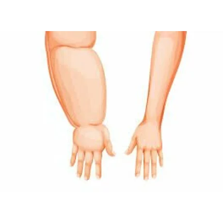 Aparat de presoterapie pentru drenaj limfatic si masaj pntru brat Alhena® M-PRO 3001, 1 X 4 camere de compresie aer, 6 moduri de tratament, 30-250 mmHg, recuperare medicala, masaj terapeutic, refacere musculara, marimea L, negru