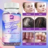 Complex Biotina pentru piele, par si unghii, bomboane gumate, suport pentru frumusete, previne caderea parului, 60 buc