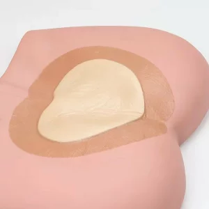 Pansament antiescara, ulcere varicoase, Alhena®, incizii operatorii, utilizat pentru rani cu exudare puternica, din spuma cu adeziv siliconic cu margine blanda pentru ingrijirea ranilor, 18X18 cm