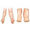 Aparat de presoterapie pentru drenaj limfatic si masaj Alhena® M-PRO 3001, 4 X 4 camere de compresie aer, 6 moduri de tratament, 30-250 mmHg, recuperare medicala, masaj terapeutic, refacere musculara, marimea XL, negru