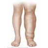 Aparat de presoterapie pentru drenaj limfatic si masaj Alhena® M-PRO 3001, 2 X 6 camere de compresie aer, 6 moduri de tratament, 30-250 mmHg, recuperare medicala, masaj terapeutic, refacere musculara, marimea XL, negru