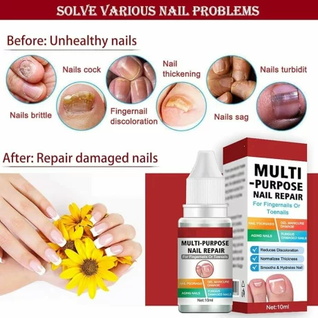 Solutie de reparare a unghiilor, Antifungica, Lotiune organica pentru reinnoirea unghiilor deteriorate, crapate, aspre, decolorate, ingalbenite, ciuperca unghiei, 10 ml, Envisha
