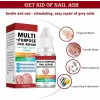 Solutie de reparare a unghiilor, Antifungica, Lotiune organica pentru reinnoirea unghiilor deteriorate, crapate, aspre, decolorate, ingalbenite, ciuperca unghiei, 10 ml, Envisha