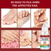 Solutie de reparare a unghiilor, Antifungica, Lotiune organica pentru reinnoirea unghiilor deteriorate, crapate, aspre, decolorate, ingalbenite, ciuperca unghiei, 10 ml, Envisha