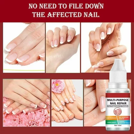 Solutie de reparare a unghiilor, Antifungica, Lotiune organica pentru reinnoirea unghiilor deteriorate, crapate, aspre, decolorate, ingalbenite, ciuperca unghiei, 10 ml, Envisha