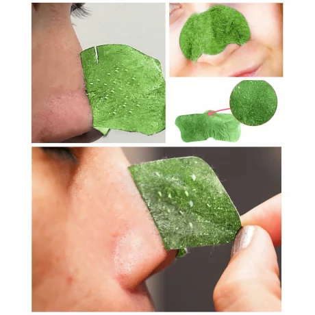 Set 5 plasturi pentru puncte negre cu Arbore de Ceai si Aloe Vera, Vibrant Glamour
