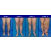 Aparat de presoterapie pentru drenaj limfatic si masaj Alhena® M-PRO 3001, 2 X 8 camere de compresie aer, 6 moduri de tratament, 30-250 mmHg, recuperare medicala, masaj terapeutic, refacere musculara, marimea XXL, negru
