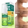 Gel organic din silicon pentru îndepărtarea cicatricilor, pentru cicatrici chirurgicale, față, corp, arsuri la picioare, acnee, vergeturi pentru cezariană, tratamente pentru cicatrici keloide