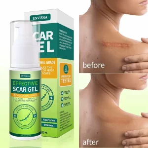 Gel organic din silicon pentru îndepărtarea cicatricilor, pentru cicatrici chirurgicale, față, corp, arsuri la picioare, acnee, vergeturi pentru cezariană, tratamente pentru cicatrici keloide