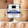 Envisha Advanced Scar Removal 50 ml, Cremă organică pentru cicatrici faciale, burtă, picioare, coșuri, vergeturi, eficientă pentru îndepărtarea cicatricilor acneice
