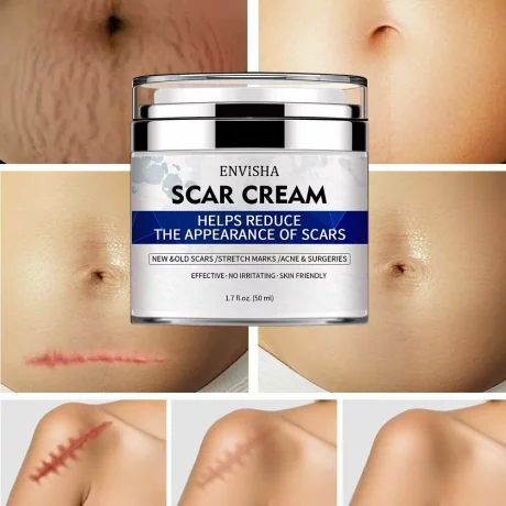 Envisha Advanced Scar Removal 50 ml, Cremă organică pentru cicatrici faciale, burtă, picioare, coșuri, vergeturi, eficientă pentru îndepărtarea cicatricilor acneice