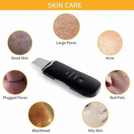 Aparat Ultrasunete Curatare Ten, Alhena®, Spatula Faciala Ultrasonica 26.000 Vibratii/Minut Pentru Exfoliere si Eliminarea Impuritatilor, negru