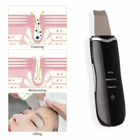 Aparat Ultrasunete Curatare Ten, Alhena®, Spatula Faciala Ultrasonica 26.000 Vibratii/Minut Pentru Exfoliere si Eliminarea Impuritatilor, negru