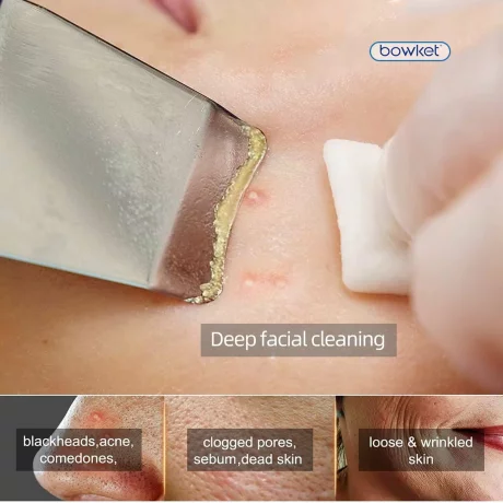 Scrubber cu ultrasunete, lifting facial, ajută la îndepărtarea impurităților, Vibrații cu ultrasunete de 26000 de ori/minut, alb