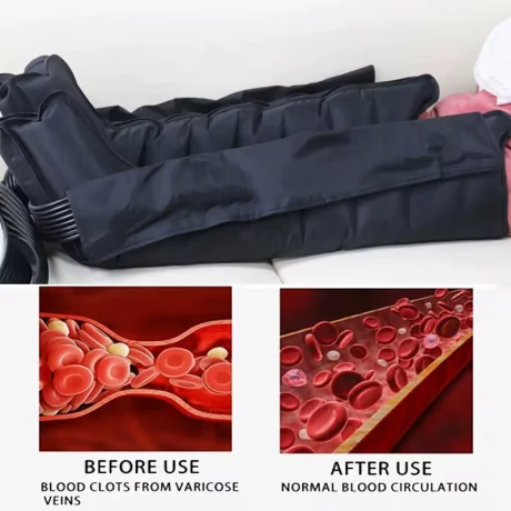 Aparat de presoterapie pentru drenaj limfatic si masaj Alhena® M-PRO 3001, 2 X 6 camere de compresie aer, 6 moduri de tratament, 30-250 mmHg, recuperare medicala, masaj terapeutic, refacere musculara, marimea XL, negru