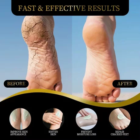 Cremă reparatoare vegană Alhena®, pentru picioare și mâini, hidrateaza în profunzime, calmează, îndepărtează pielea moartă, balsam pentru picioare cu arbore de ceai, 60g