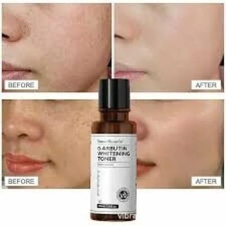 Vibrant Glamour Alpha-arbutin Toner 100ml