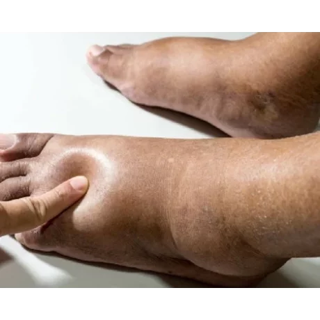 Aparat de presoterapie, drenaj limfatic si masaj, XXL pantalon talie inalta Alhena®M-PRO 3001, 2 X 8 camere de compresie aer, 6 moduri de tratament, 30-250 mmHg, recuperare medicala, masaj terapeutic, refacere musculara