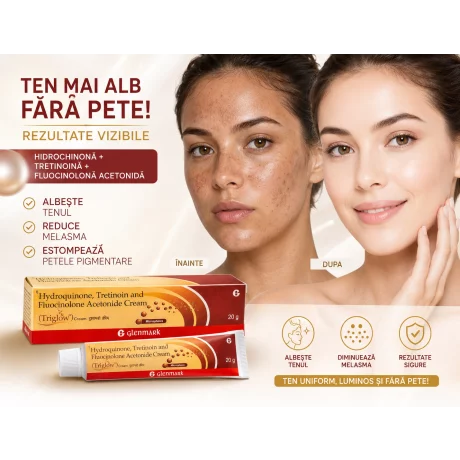 Triglow, crema depigmentanta, 20g