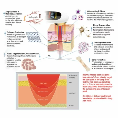 Laser terapeutic profesional, Tratamentul Durerii, Terapie de reabilitare, Regenerarea nervilor, Stomatologie, ORL, Reumatism articular/degenerativ, Vindecarea ranilor, Alhena®, JN-600, alb