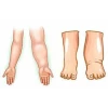 Aparat de presoterapie pentru drenaj limfatic, pantalon talie inalta plus mana, Alhena®M-PRO 3001, 3X6 camere de compresie aer, 6 moduri de tratament, 30-250 mmHg, recuperare medicala, anticelulitic, limfedem, marimea XL, 142/83 negru