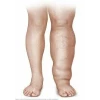 Aparat de presoterapie pentru drenaj limfatic, pantalon talie inalta plus mana, Alhena®M-PRO 3001, 3X6 camere de compresie aer, 6 moduri de tratament, 30-250 mmHg, recuperare medicala, anticelulitic, limfedem, marimea XL, 142/83 negru