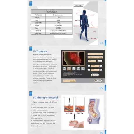 Shockwave, the treatment of erectile dysfunction, repararea tendoanelor și reabilitare, ESWT-KA