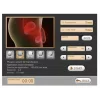 Shockwave, the treatment of erectile dysfunction, repararea tendoanelor și reabilitare, ESWT-KA