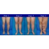 Aparat de presoterapie pentru drenaj limfatic, pantalon talie inalta plus mana, Alhena®M-PRO 3001, 3X6 camere de compresie aer, 6 moduri de tratament, 30-250 mmHg, recuperare medicala, anticelulitic, limfedem, marimea XL, 142/83 negru