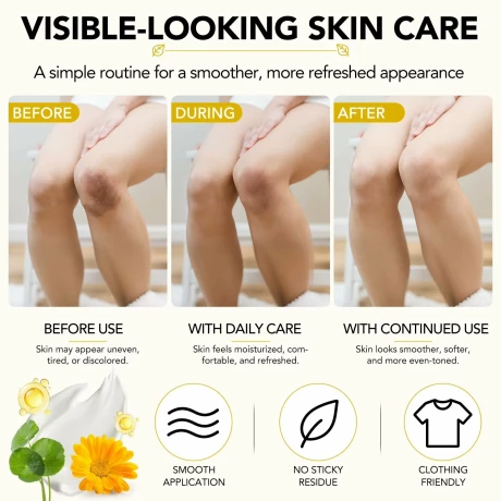 Complex cu Arnica Montana, vitamina K, C, E Masaij, 4 în 1 pentru vindecarea vânătăilor, pentru ten fragil, predispus la vânătăi