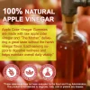 Jeleuri cu otet de mere  vegane pentru slăbit, Oțet de mere pur natural  pentru sănătate digestivă , SOLOTREE, 90 buc